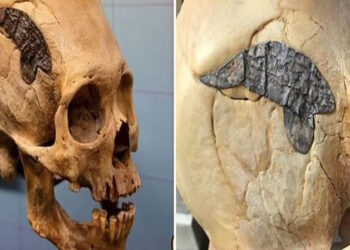 Archaeologists Stunned As 2,000-Year-Old Skull Bound By Metal Evidence Of Ancient Surgery