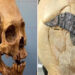 Archaeologists Stunned As 2,000-Year-Old Skull Bound By Metal Evidence Of Ancient Surgery