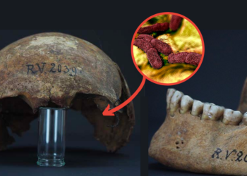 In 5,000-Year-Old Human Remains, The Oldest Strain Of Black Death Germs Was Discovered