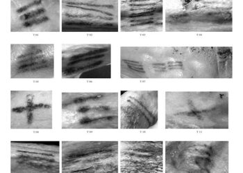 Scientists Have Mapped All of Ötzi the Iceman’s 61 Tattoos